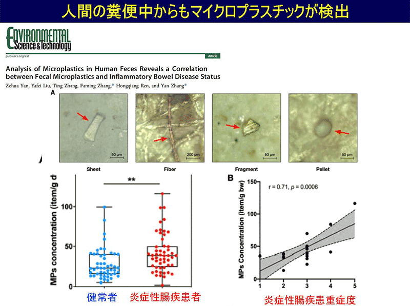 東京農工大 高田秀重教授資料より。腸に炎症を起こした患者の体内からマイクロプラスチックが発見されている。