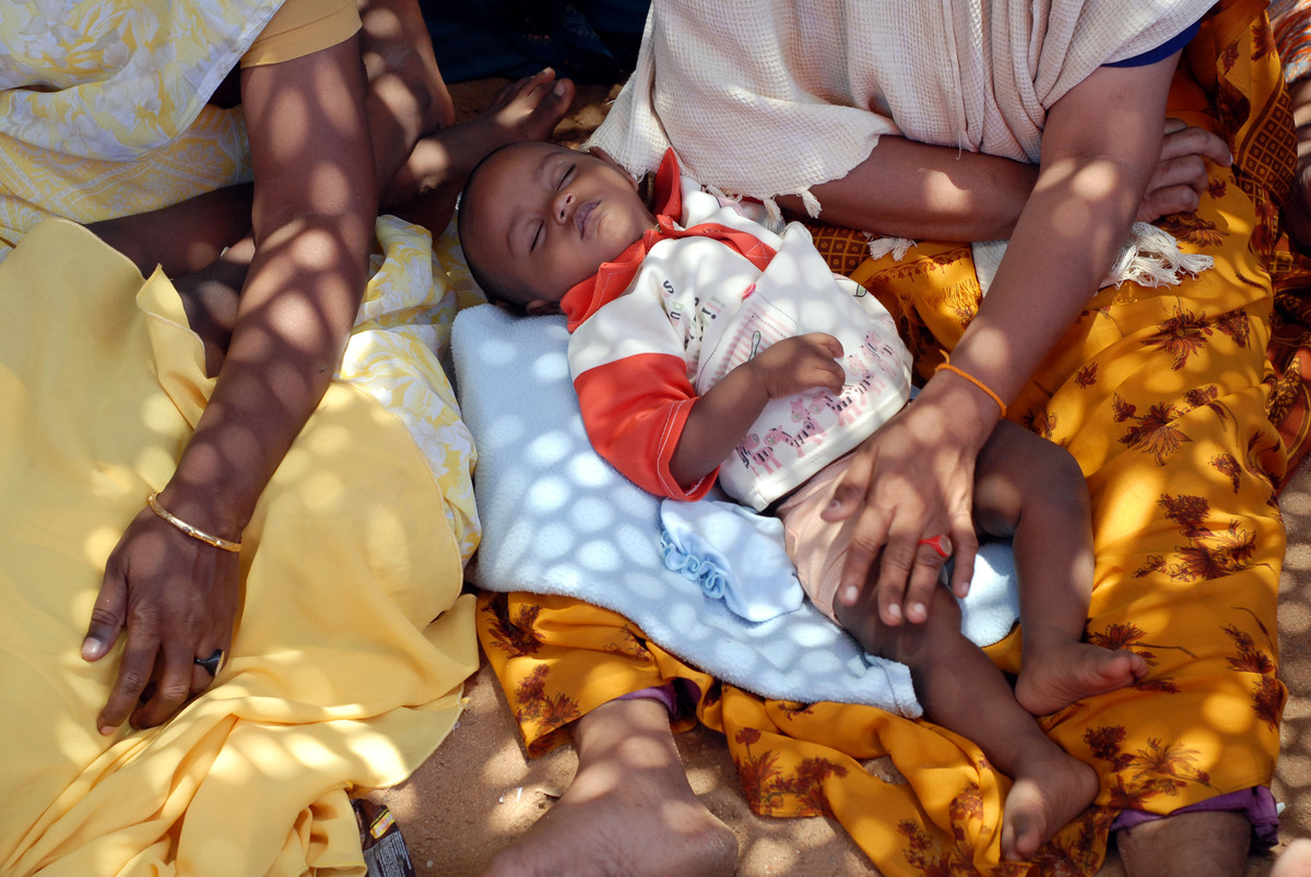 生活在印度的5歲以下兒童，有3分之2因營養不良而死亡。
